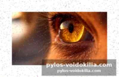 Quelles lunettes détecte-t-elle?